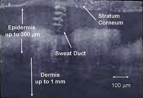 The helical form of sweat ducts act like tiny RF antennas